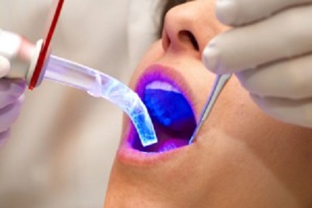 Laser-Dentistry-400