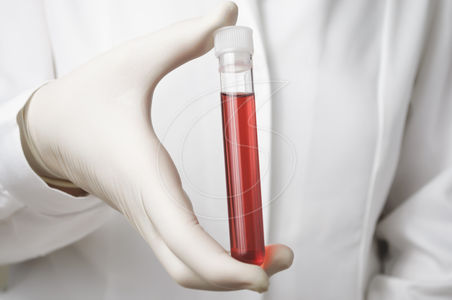 blood sample 2_5981_93
