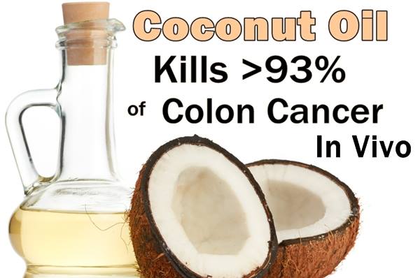 coconut-oil-colon-cancer