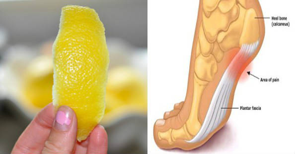 lemon-peel-joint-pain