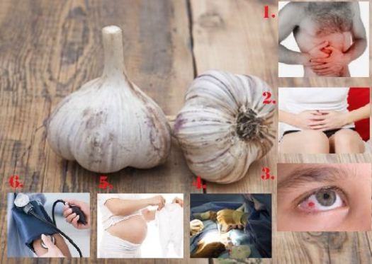 garlic-not-advisable-for
