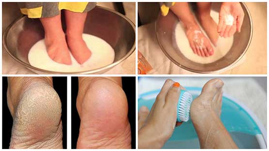 pedicure-at-home