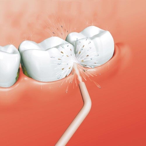 Съвет на зъболекаря: Спрете да почиствате зъбите си с конец!