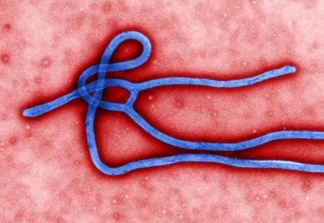 Нов случай на Ебола ПОТВЪРЖДАВА некомпетентността на правителството