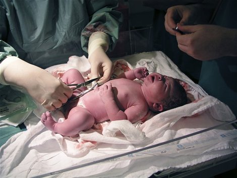 Пъпната връв: 2-минутна забава в отрязването й подобрява развитието на новороденото