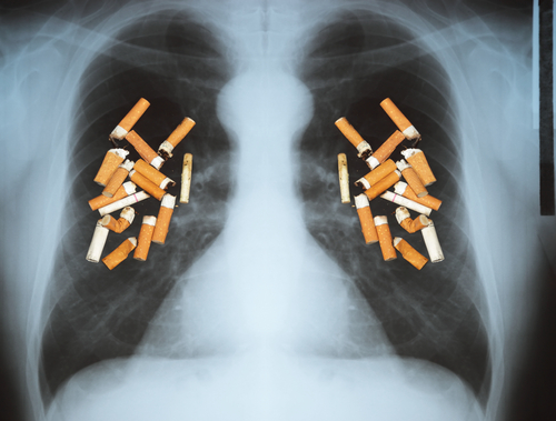 Шест начина за прочистване и обновяване на белите дробове за пушачи и бивши пушачи