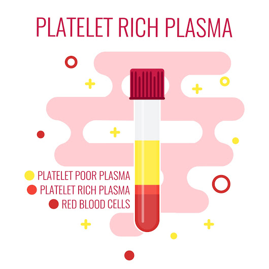 Инжекциите с богата на тромбоцити плазма регенерират тъкани и спират менопаузата