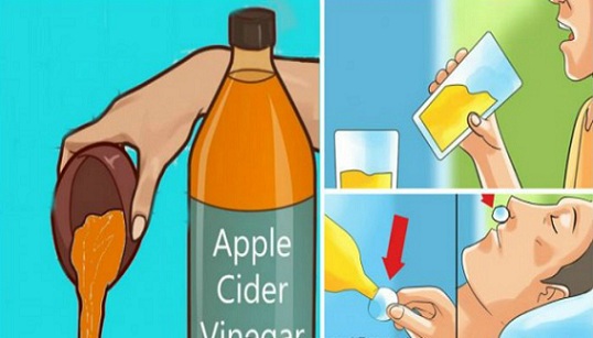 Пийте ябълков оцет преди лягане, подобрете здравето си
