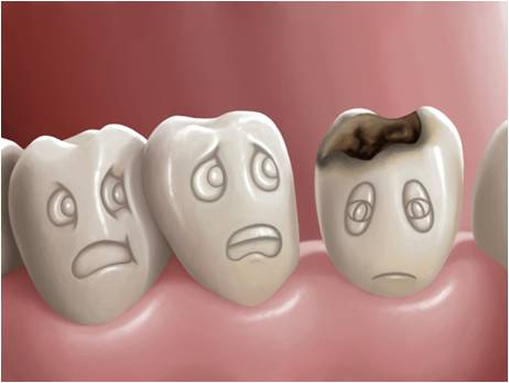 Лекувайте кариесите и снижавайте болката бързо без да ходите на зъболекар
